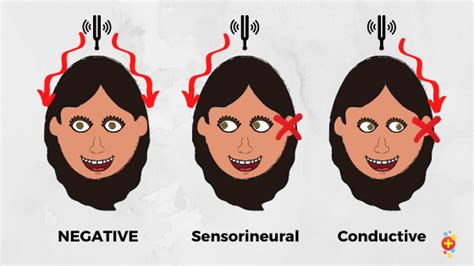 cerumen impaction weber test|how to interpret weber's tests.